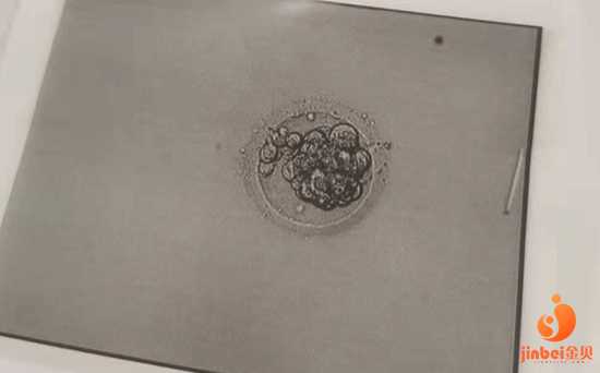 杭州邵逸夫试管移植篇